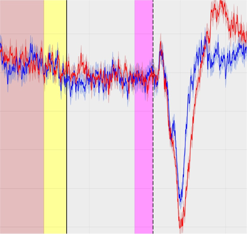 Potentiels évoqués - Analyse des réponses cérébrales